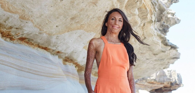 Telstra NSW Business Women’s Awards: finalists